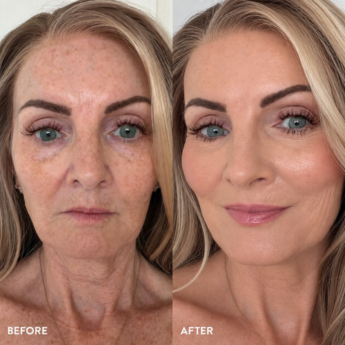 Age-Defying Adaptive Foundation